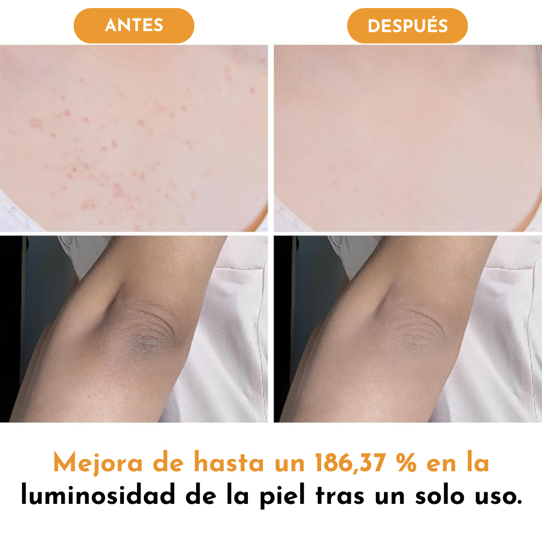 Spray Exfoliante de Piel